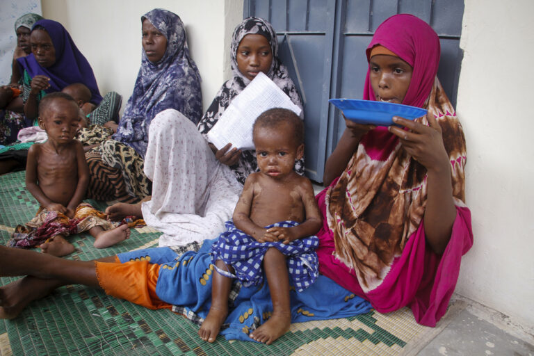 Somali children displaced by drought and showing symptoms of Kwashiorkor, a severe protein malnutrition causing swelling and skin lesions, sit with their mothers at a malnutrition stabilization center run by Action against Hunger, in Mogadishu, Somalia Sunday, June 5, 2022. Deaths have begun in the region's most parched drought in decades and previously unreported data show nearly 450 deaths this year at malnutrition treatment centers in Somalia alone. (AP Photo/Farah Abdi Warsameh)